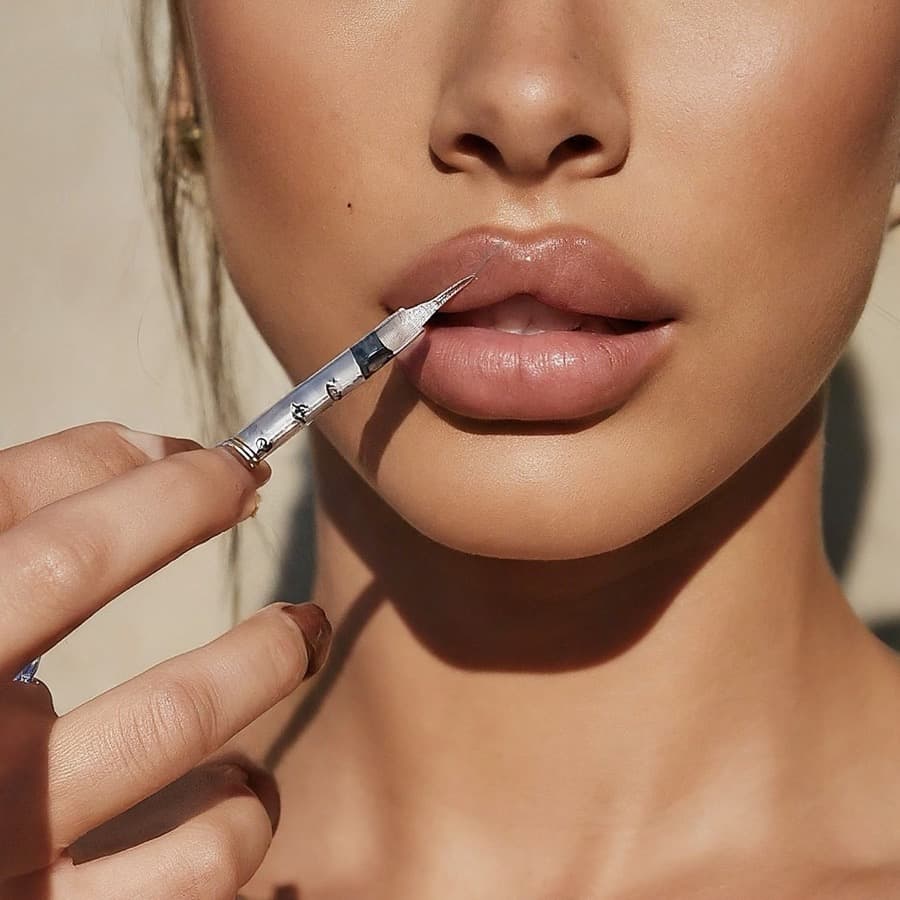 Lip Filler — Soft, Natural Volume