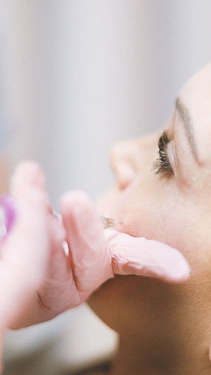 Restylane Lyft — Cheek & Midface Volume Restoration